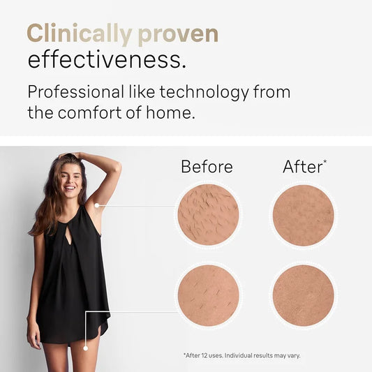 Wireless IPL Laser Hair Remover with Ice Care