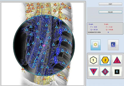 18D NLS Aura and Chakra Body Analyzer with Iriscope