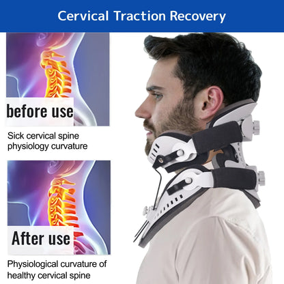 Adjustable Neck Brace Support for Posture and Pain Relief