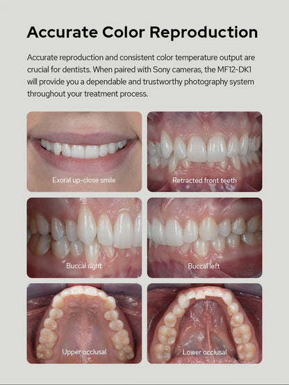 MF12 Dental Flash Speedlight with TTL Wireless
