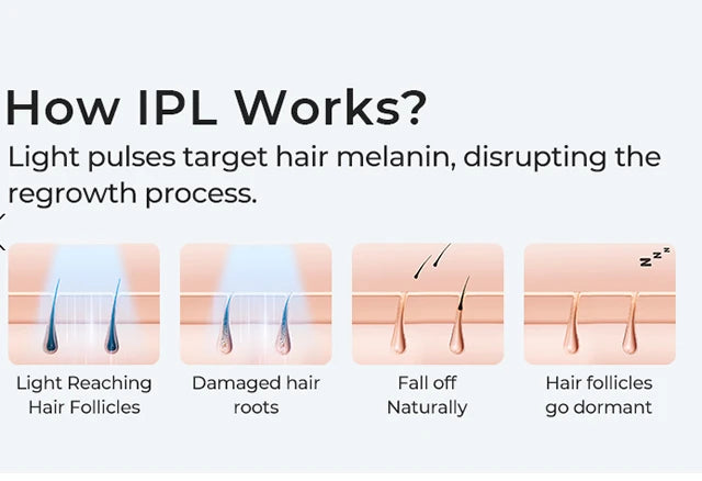 Wireless IPL Laser Hair Remover with Ice Care