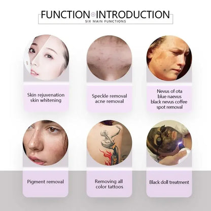 Professional Pico Laser Tattoo Freckle Removal Device 220V